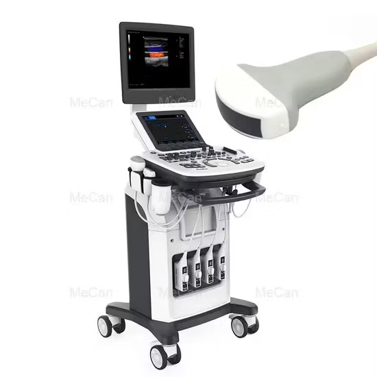 Digital Color Doppler Ultrasound System (3D/4D)
